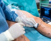 The Dangers of Botched Venous Surgery